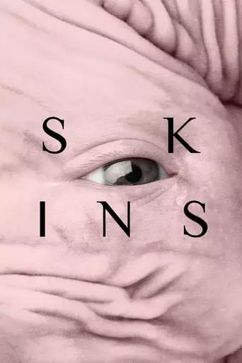 Skins (2017) Watch Online